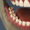 2637 Human Dental Skull Teeth Gums Tongue
