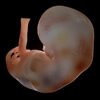 EmbryoFetusPack th015